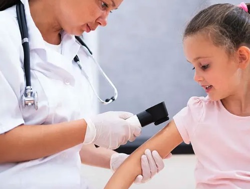 Алергічні висипи у дітей: коли потрібен дерматолог у Хмельницькому